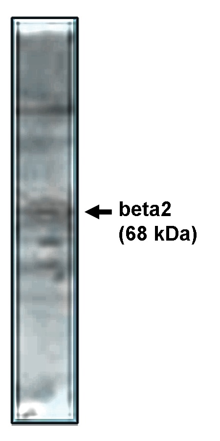 Western blot analysis  using beta2 antibody on rat brain lysate.